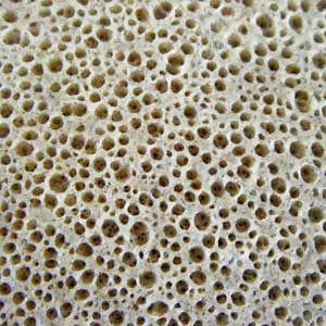 пористість